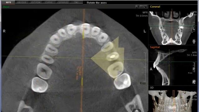 Ez3d2009 1 я часть смотреть онлайн
