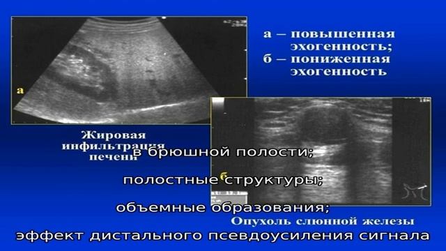 Почему эхогенность печени повышена и что это означает смотреть онлайн