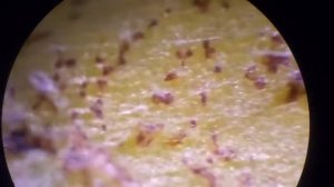 как бороться с клещами на суккулентах