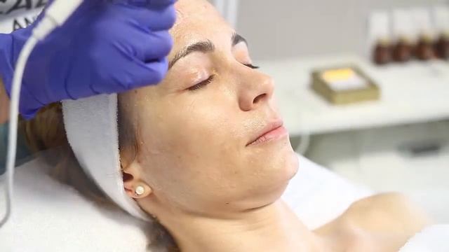 Sesderma - DNA Recovery Peel System I Nanopore Turbo-Roller