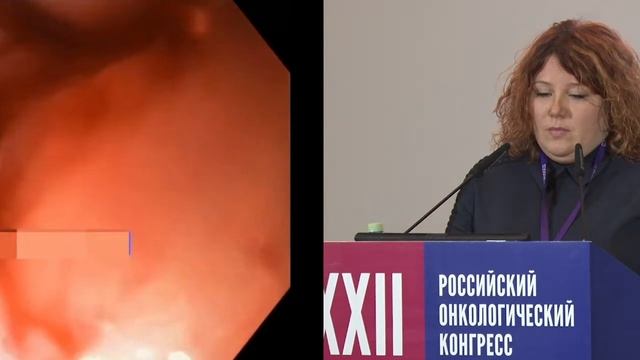 Профилактика и лечение осложнений при эндоскопическом стентировании пищевода при опухолевом стенозе смотреть онлайн