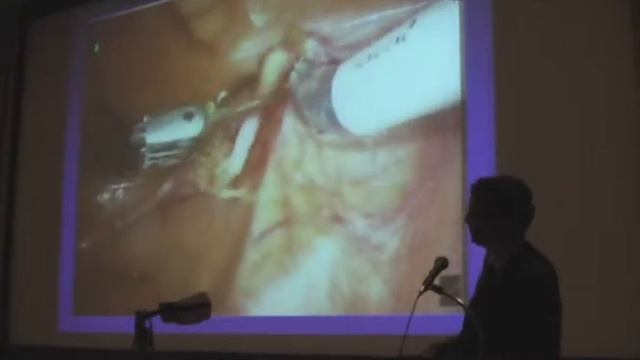 Dr. Michael Hobart on "The DaVinci Robot" смотреть онлайн