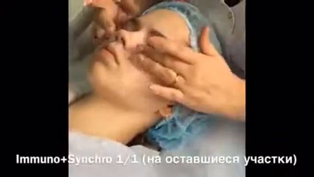 Gernetic уход за жирной кожей лица смотреть онлайн