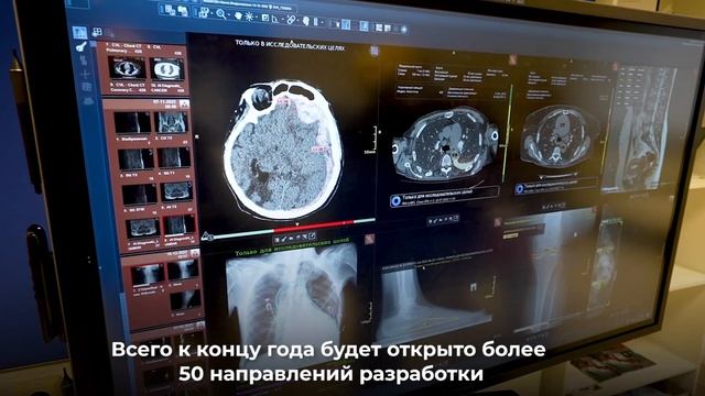 Искусственный интеллект теперь находит признаки ишемического инсульта и помогает московским врачам смотреть онлайн