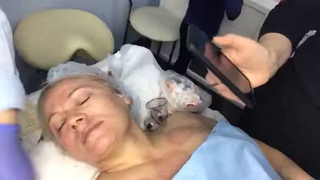 Хиджама весь процесс смотреть онлайн