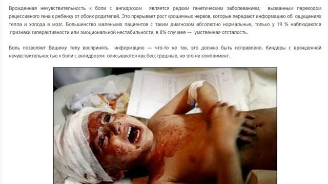 Не чувствовать боль: Аномалии Тела смотреть онлайн