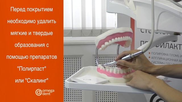 Фторлак - противокариесная и профилактическая жидкость. смотреть онлайн