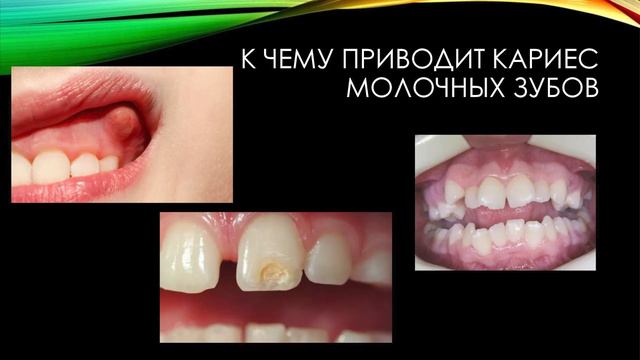 Медики для немедиков: уход за полостью рта у детей до трёх лет смотреть онлайн