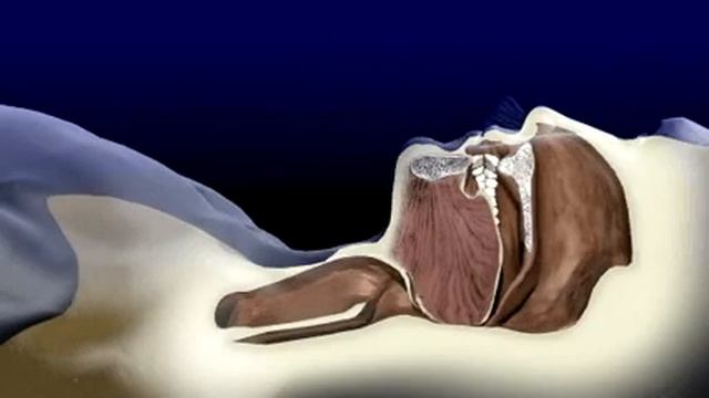 Срез апноэ смотреть онлайн