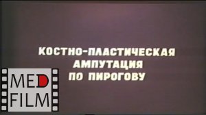 Ампутация по Пирогову © Pirogov's amputation