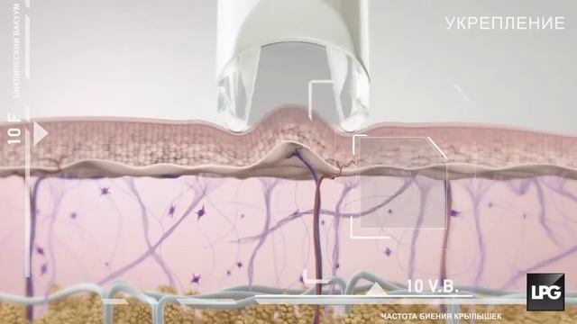 LPG Integral смотреть онлайн