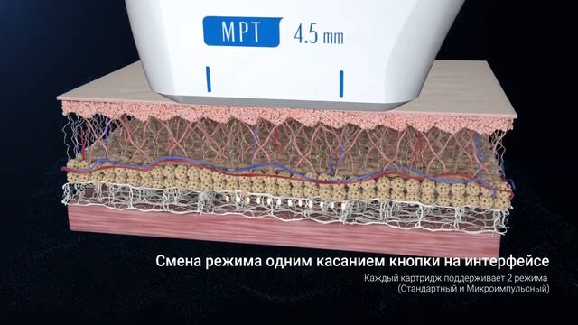 Ultraformer MPT - аппарат по SMAS ЛИФТИНГУ смотреть онлайн