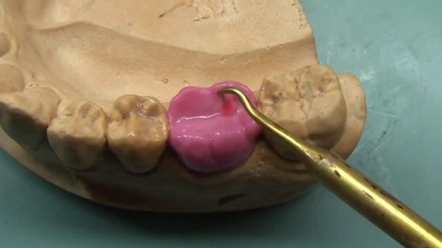 Dental Wax Up Molar 36 [Waxup Tutorial With Explanation] For Dental Study And Dental Technician