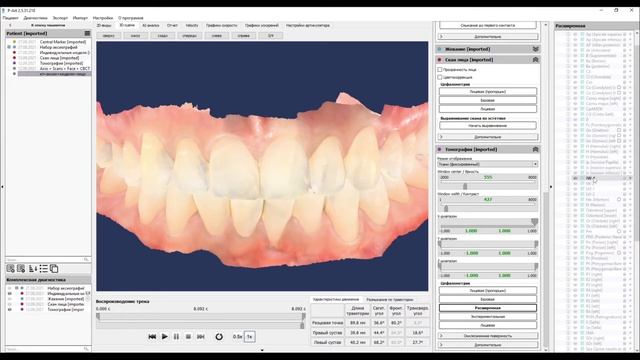 26. Индекс Шимбачи.