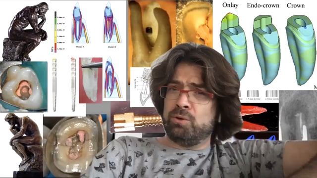 Эндодонтия и Ортопедия www.solomonov.pro смотреть онлайн