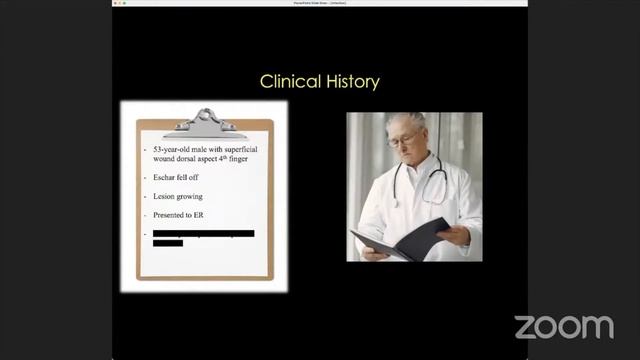 Focus on Infection - OCAD/SRad-RJ MSK Case Presentation Series смотреть онлайн