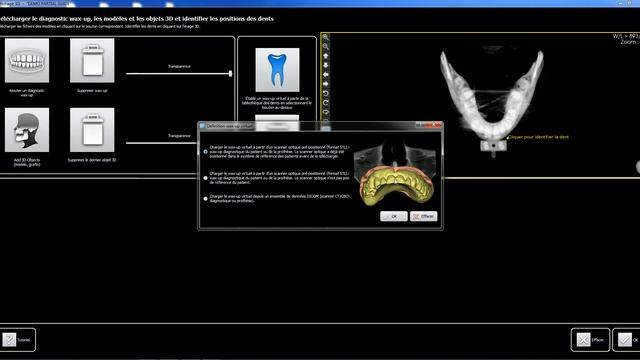 Matching technique for Surgical guides STL files, optical scanner 1 смотреть онлайн