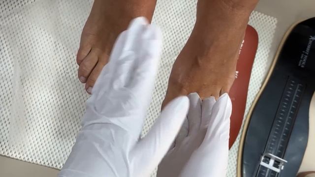 Почему отслоились ногти? Причины Онихолизиса / Ноготь отошел от ложа Причины / Удобная обувь / смотреть онлайн