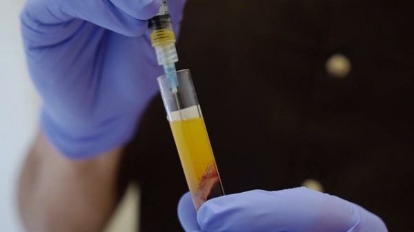 Правила получения плазмы - Plasmatherapy FAQ by Dr. Shkolnyi