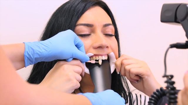 Отбеливание зубов в «Галактике» смотреть онлайн