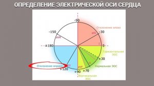 О ЧЕМ РАССКАЖЕТ ЭКГ. ЧАСТЬ 2. РАСШИФРОВКА ЭКГ. РАЗБОР ПРИМЕРОВ ЭКГ #экг  #ДокторАлексейЛазарев
