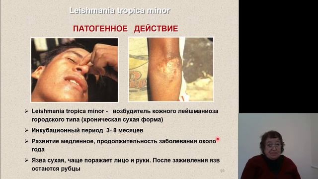 Биология. Простейшие - паразиты человека смотреть онлайн
