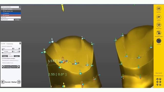 DENTAL - EXOCAD 2015 - Modellation von Teleskopen TEIL 3 by Michael Anger смотреть онлайн