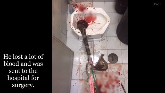 11ft Python Bites Man While He Sits on the Toilet after it Slithered up Sewer Pipes смотреть онлайн