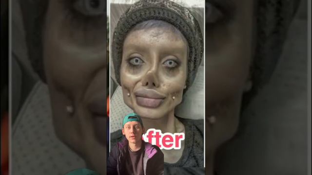 Фейлы пластической хирургии #tiktok #подпишись #тренды #рекомендации #реакция #мемы #рек #2023 смотреть онлайн