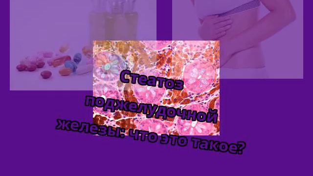 Стеатоз поджелудочной железы: что это такое? смотреть онлайн