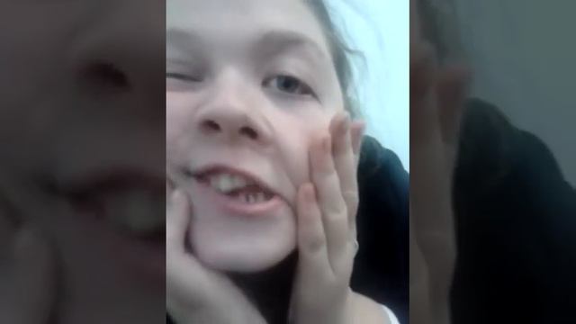 Девочка с синдромом "дауна" смотреть онлайн