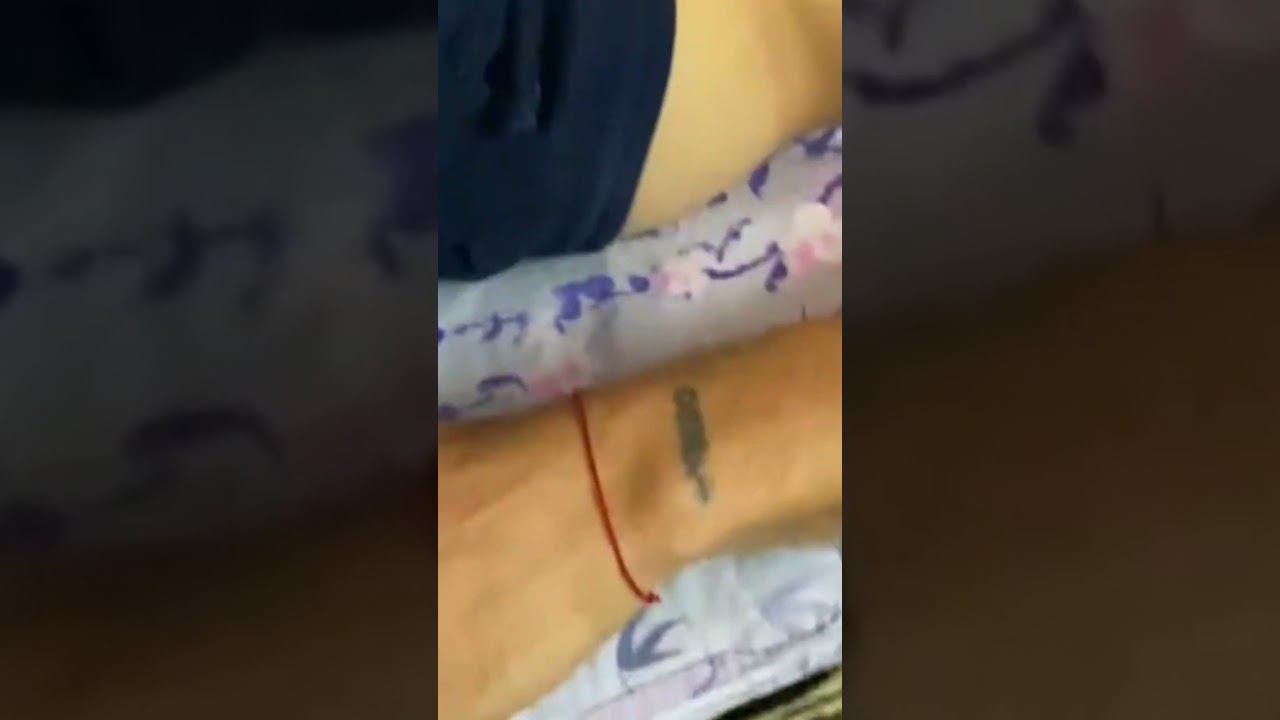 ВИСЦЕРАЛЬНЫЙ МАССАЖ ( ПРАВКА ЖИВОТА). ВИДЕО С СЕМИНАРА смотреть онлайн