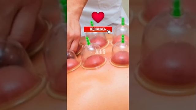 Зачем ставят банки на спину? #shorts