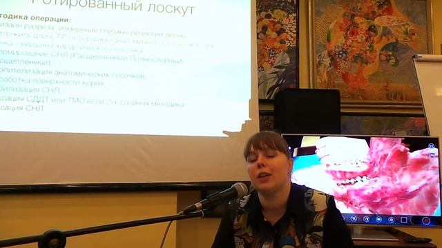 23.04.16. Мария Носова. Практикум по пластике десны. Эпизод 22 смотреть онлайн