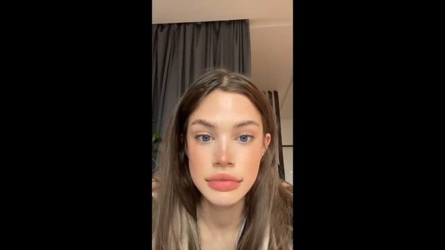 акулич увеличила губы