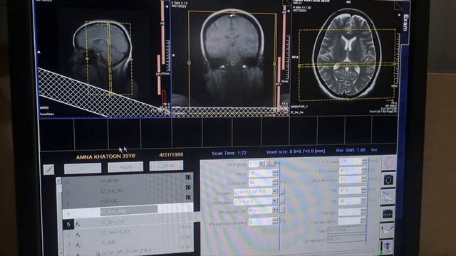 #How to do MRI Brain on siemens 1.5 Tesla. смотреть онлайн