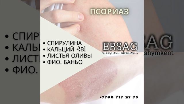 Псориаз #ersag #эрсаг #халяль #kazakhstan #псориаз #псориазсамолечение #крем смотреть онлайн