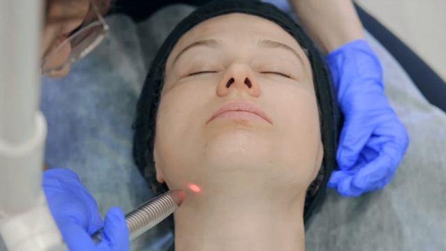 МГНОВЕННОЕ ЛАЗЕРНОЕ SMOOTH ОМОЛОЖЕНИЕ ЛИЦА смотреть онлайн