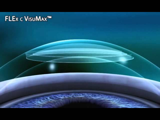 ReLEx flex смотреть онлайн