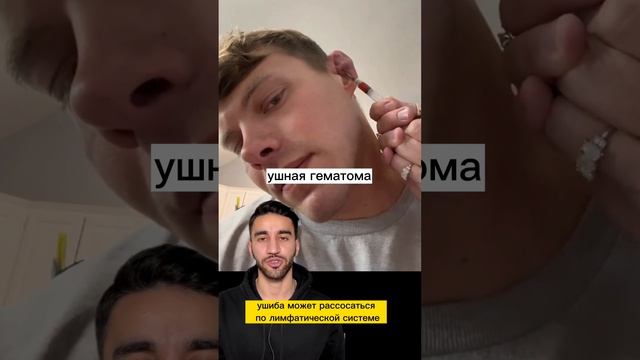 уши борца смотреть онлайн