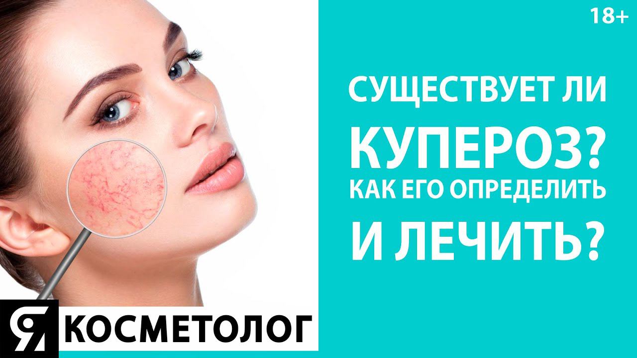 Существует ли купероз? Как его определить и лечить?