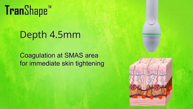 Compact HIFU system - Transhape EHM15 смотреть онлайн