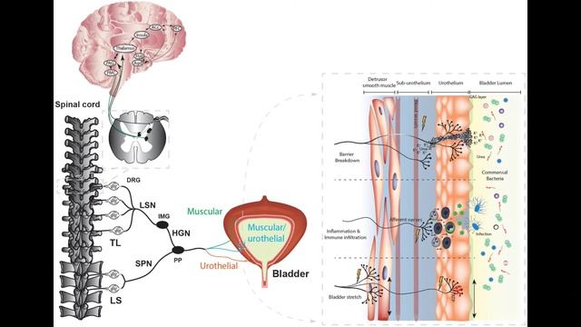 How To Train Your Bladder + 2 Recipes For Strenghten The Bladder смотреть онлайн
