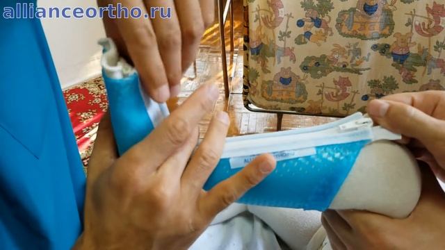 20180908 144143 Allianceortho Ru No Audio