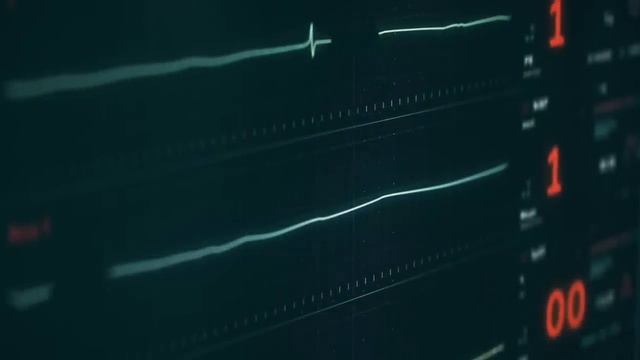 Recognizing a heart attack | 3D Animation смотреть онлайн