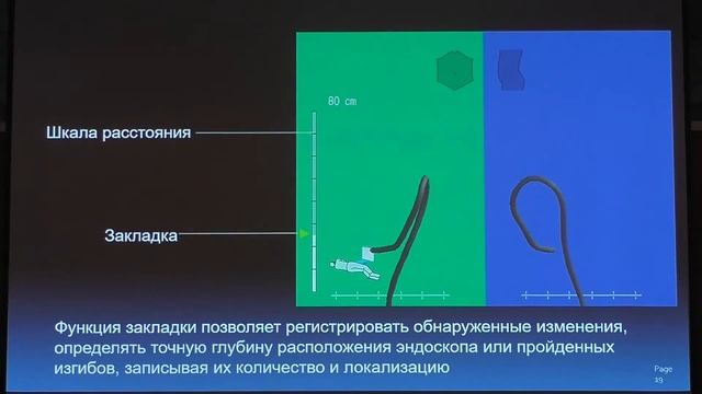 32 Федоров ЕД ScopeGuide Навигатор для Колоноскопа смотреть онлайн