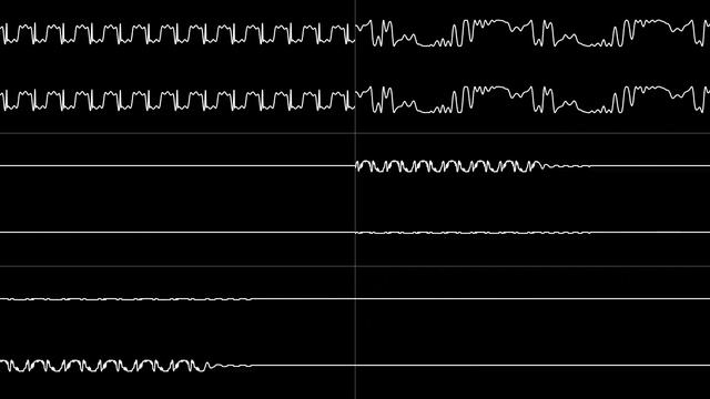 Sonic the Hedgehog 3 (1993 Prototype) - "Unused Theme (Song 2E)" [Oscilloscope View] смотреть онлайн